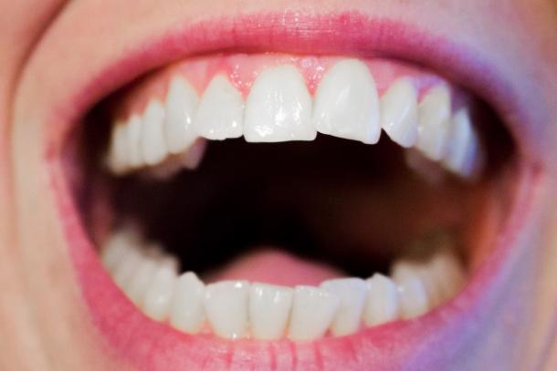 Zahngesundheit – mehr als gesunde Zähne