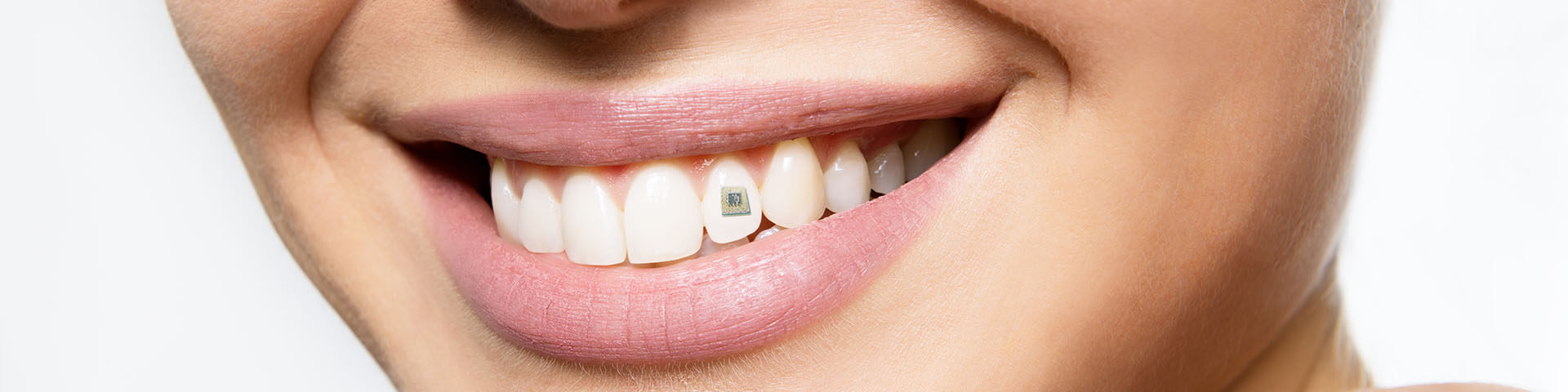 Zahn-Chip trackt was wir wirklich zu uns nehmen